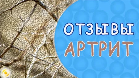 ОТЗЫВ. Отпускает даже АРТРИТ.