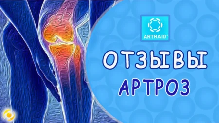 ОТЗЫВ. АРТРОЗ колена