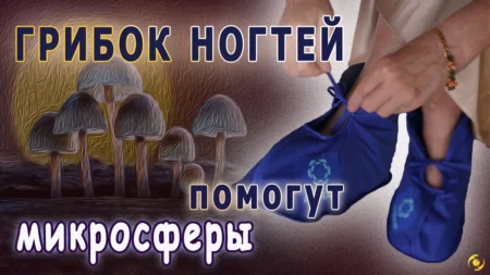 ОТЗЫВ. ГРИБОК ногтей. Без стыда иду в бассейн. Помогли МИКРОСФЕРЫ