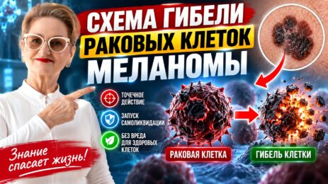 Схема гибели раковых клеток меланомы.